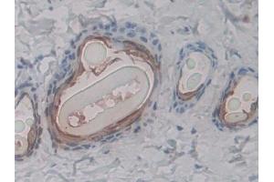 Detection of RAGE in Rat Skin Tissue using Polyclonal Antibody to Receptor For Advanced Glycation Endproducts (RAGE)