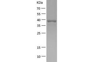 Western Blotting (WB) image for ELAC1 (ELAC1) (AA 1-363) protein (His tag) (ABIN7122752)