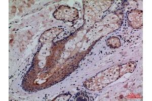 Immunohistochemistry (IHC) analysis of paraffin-embedded Human Skin, antibody was diluted at 1:100. (CD68 anticorps  (Internal Region))