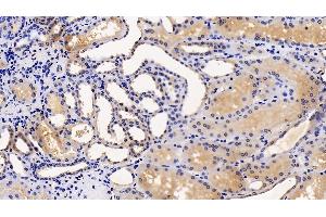 Detection of TMPRSS2 in Human Kidney Tissue using Polyclonal Antibody to Transmembrane Protease, Serine 2 (TMPRSS2) (TMPRSS2 anticorps  (AA 284-492))