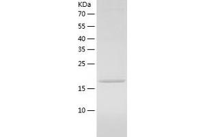 Western Blotting (WB) image for Signal Recognition Particle 14kDa (Homologous Alu RNA Binding Protein) (SRP14) (AA 1-160) protein (His-IF2DI Tag) (ABIN7125090)