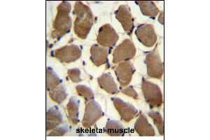 LRP3 Antibody (C-term) (ABIN390097 and ABIN2840611) immunohistochemistry analysis in formalin fixed and paraffin embedded human skeletal muscle followed by peroxidase conjugation of the secondary antibody and DAB staining. (LRP3 anticorps  (C-Term))