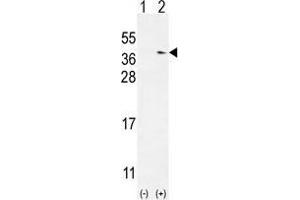Western blot analysis of TXNDC6 (arrow) using rabbit polyclonal TXNDC6 Antibody (Center) .