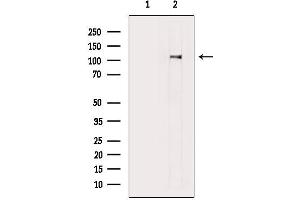 Western blot analysis of lysates from LoVo cells, using AR Mouse Monoclonal Antibody.