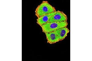 Immunofluorescence analysis of Hela cells using C3C mouse mAb (green). (Complement C3c anticorps  (AA 1521-1649))