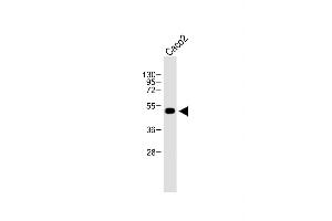 Anti-WTIP Antibody (C-term) at 1:500 dilution + Caco2 whole cell lysate Lysates/proteins at 20 μg per lane. (WTIP anticorps  (AA 243-271))