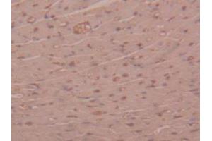 IHC-P analysis of Mouse Heart Tissue, with DAB staining. (alpha 2 Macroglobulin anticorps  (AA 1053-1214))