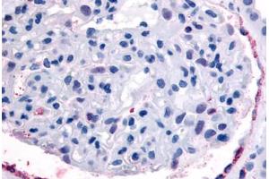 Anti-EPHA4 antibody  ABIN1048570 IHC staining of human kidney, glomerulus. (EPH Receptor A4 anticorps  (Internal Region))