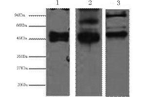 Western Blotting (WB) image for anti-Keratin 17 (KRT17) antibody (ABIN5959216) (KRT17 anticorps)