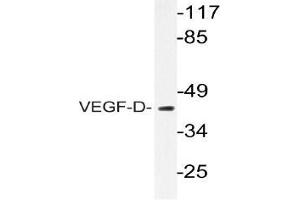 Western blot (WB) analyzes of VEGF-D antibody in extracts from COS-7 cells. (VEGFD anticorps)