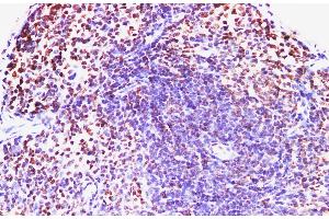 Immunohistochemistry of paraffin-embedded Mouse spleen using IFNAR1 Polyclonl Antibody at dilution of 1:200. (IFNAR1 anticorps)