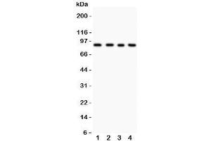 Western blot testing of IKKb antibody and Lane 1:  HEPG2;  2: COLO320;  3: M231;  4: HT1080 lysate. (IKBKB anticorps  (AA 398-756))