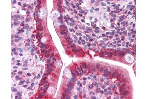 LGALS3 antibody was used for immunohistochemistry at a concentration of 4-8 ug/ml.