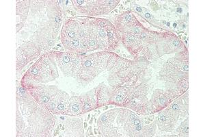 Anti-SLC3A2 / CD98 antibody IHC staining of human kidney. (SLC3A2 anticorps  (AA 89-433))