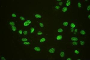 IF analysis of HAUSP/USP7 using anti-HAUSP/USP7 antibody (ABIN6719603). (USP7 anticorps  (AA 258-483))