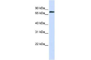 WB Suggested Anti-ZNF714 Antibody Titration:  0. (ZNF714 anticorps  (N-Term))