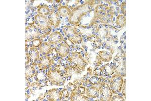 Immunohistochemistry of paraffin-embedded rat kidney using BMP15 antibody (ABIN5975746) at dilution of 1/100 (40x lens). (BMP15 anticorps)