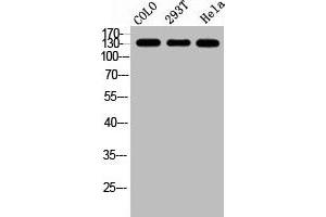 Western Blot analysis of COLO 293T HELA cells using GPR158 Polyclonal Antibody (GPR158 anticorps  (N-Term))