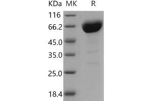 Western Blotting (WB) image for Basigin (Ok Blood Group) (BSG) (Active) protein (His tag,Fc Tag) (ABIN7320311)