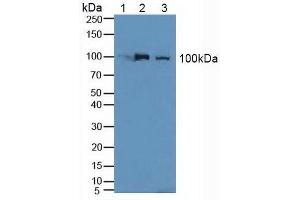 Rabbit Capture antibody from the kit in WB with Positive Control: Human liver tissue.