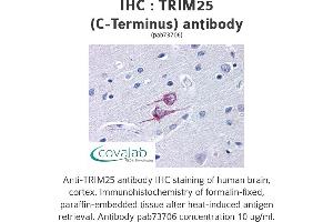 Image no. 1 for anti-Tripartite Motif Containing 25 (TRIM25) antibody (ABIN1740361) (TRIM25 anticorps)