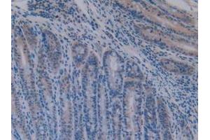 Detection of ATF1 in Mouse Intestine Tissue using Polyclonal Antibody to Activating Transcription Factor 1 (ATF1)