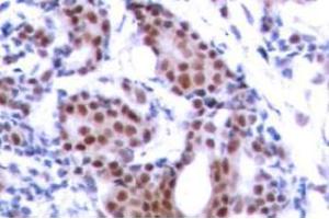 Image no. 2 for anti-ELK1, Member of ETS Oncogene Family (ELK1) (pSer383) antibody (ABIN318012) (ELK1 anticorps  (pSer383))