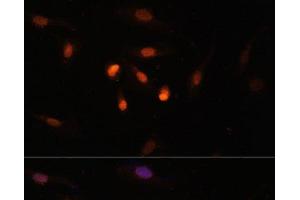 Immunofluorescence analysis of U2OS cells using KAT6A Polyclonal Antibody at dilution of 1:100. (MYST3 anticorps)