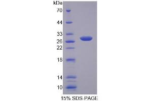 SDS-PAGE (SDS) image for Myelin Transcription Factor 1 (MYT1) (AA 903-1121) protein (His tag) (ABIN4989432)