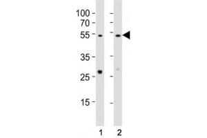 Western blot testing of EED antibody at 1:1000 dilution.