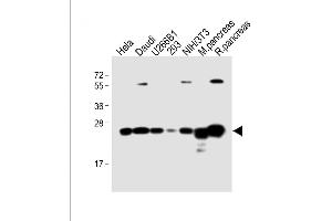 All lanes : Anti-RPL10 Antibody (N-term) at 1:4000 dilution Lane 1: Hela whole cell lysate Lane 2: Daudi whole cell lysate Lane 3: U266B1 whole cell lysate Lane 4: 293 whole cell lysate Lane 5: NIH/3T3 whole cell lysate Lane 6: Mouse pancreas lysate Lane 7: Rat pancreas lysate Lysates/proteins at 20 μg per lane. (RPL10 anticorps  (N-Term))