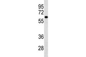 PIGS antibody western blot analysis in A549 lysate.