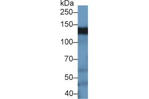 anti-Breast Cancer Anti-Estrogen Resistance 1 (BCAR1) (AA 1-240) antibody