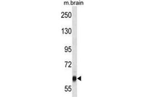 VPS45 Antibody (C-term) western blot analysis in mouse brain tissue lysates (35 µg/lane).