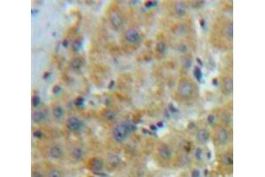 Used in DAB staining on fromalin fixed paraffin-embedded Liver tissue (APOE anticorps  (AA 19-181))