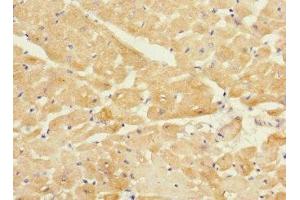 Immunohistochemistry of paraffin-embedded human heart tissue using ABIN7173550 at dilution of 1:100 (Tropomodulin 1 anticorps  (AA 1-359))