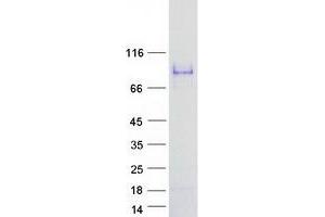 Validation with Western Blot