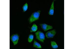 IF analysis of RPS2 using anti-RPS2 antibody (ABIN7601997). (RPS2 anticorps  (AA 54-293))