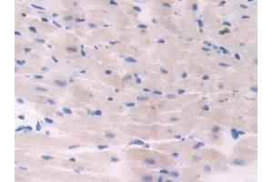 Detection of ADCY6 in Mouse Heart Tissue using Polyclonal Antibody to Adenylate Cyclase 6 (ADCY6) (ADCY6 anticorps  (AA 314-501))