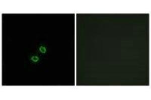 Immunofluorescence analysis of A549 cells, using KIR2DL5B antibody. (KIR2DL5B anticorps)