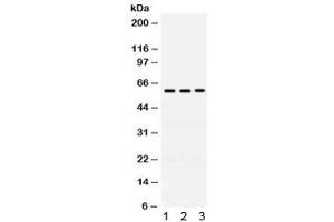 Western blot testing of human 1) A549, 2) 22RV1 and 3) U20S cell lysate with RAG2 antibody. (RAG2 anticorps)