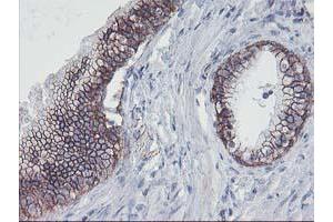 Image no. 4 for anti-Arachidonate 15-Lipoxygenase (ALOX15) antibody (ABIN1496359)