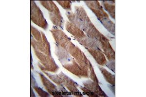 TN1 Antibody (C-term) (ABIN656749 and ABIN2845972) immunohistochemistry analysis in forlin fixed and paraffin embedded hun skeletal muscle followed by peroxidase conjugation of the secondary antibody and DAB staining. (MATN1 anticorps  (C-Term))
