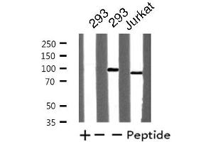 Western blot analysis of extracts from Jurkat/293 cells, using TOP1 antibody. (Topoisomerase I anticorps  (Internal Region))