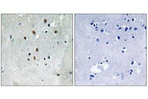 Immunohistochemistry (IHC) image for anti-Serum Response Factor (SRF) (pSer77) antibody (ABIN1847570) (SRF anticorps  (pSer77))