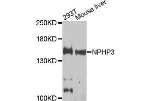 Western blot analysis of extracts of 293T and mouse liver cells, using NPHP3 antibody. (NPHP3 anticorps)