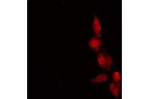 ABIN6278619 staining HeLa by IF/ICC. (OR9G1 anticorps  (Internal Region))