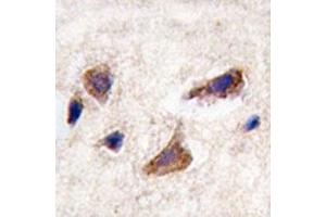IHC analysis of FFPE human brain tissue stained with CAMKK2 antibody
