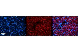 Rabbit Anti-DPH1 Antibody Catalog Number: ARP51955_P050 Formalin Fixed Paraffin Embedded Tissue: Human Liver Tissue Observed Staining: Cytoplasm in hepatocytes Primary Antibody Concentration: 1:100 Other Working Concentrations: 1:600 Secondary Antibody: Donkey anti-Rabbit-Cy3 Secondary Antibody Concentration: 1:200 Magnification: 20X Exposure Time: 0. (DPH1 anticorps  (N-Term))