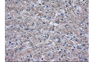 Immunohistochemical staining of paraffin-embedded Human liver tissue using anti-TBXAS1 mouse monoclonal antibody. (TBXAS1 anticorps)